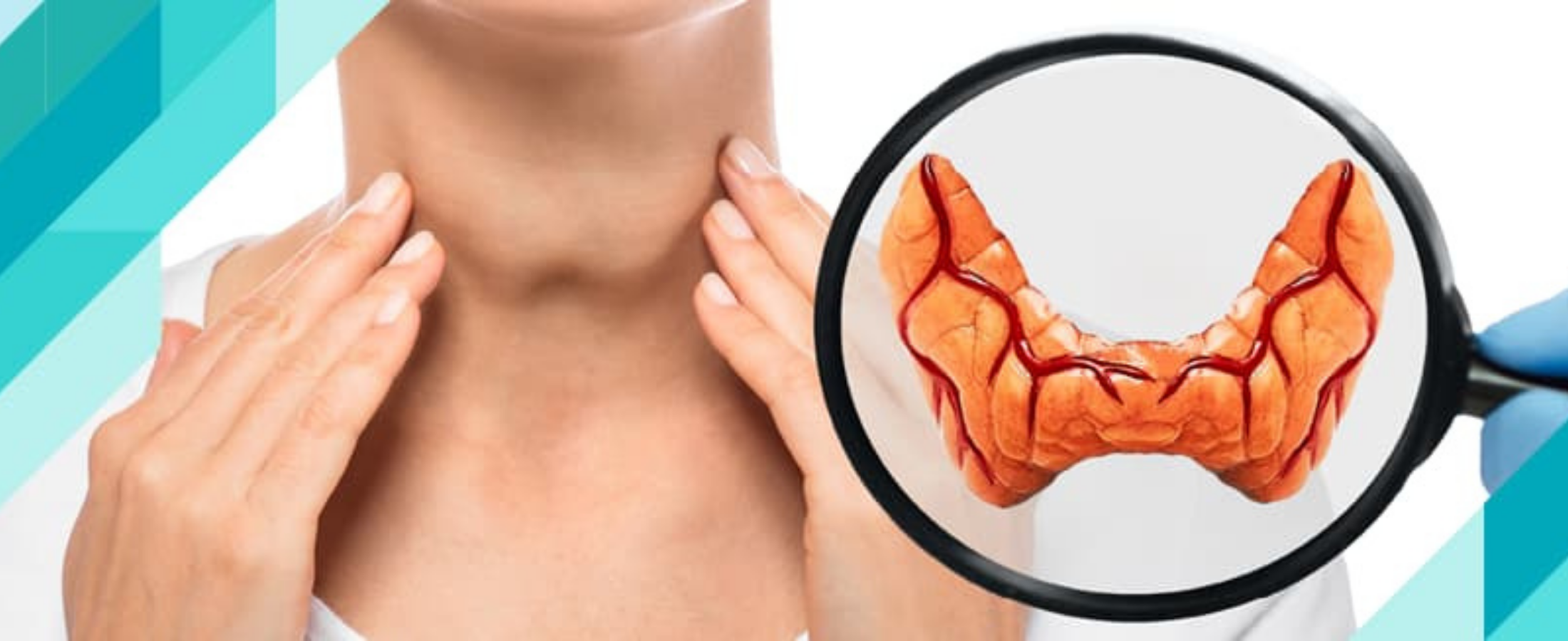 Hipertiroidi Belirtileri ve Beslenme İpuçları